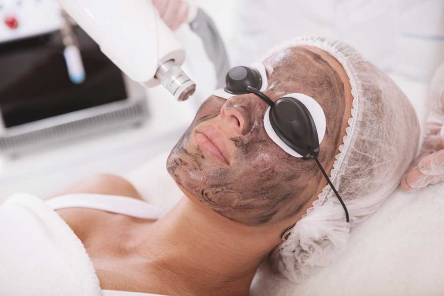 Carbon Laser Peeling img