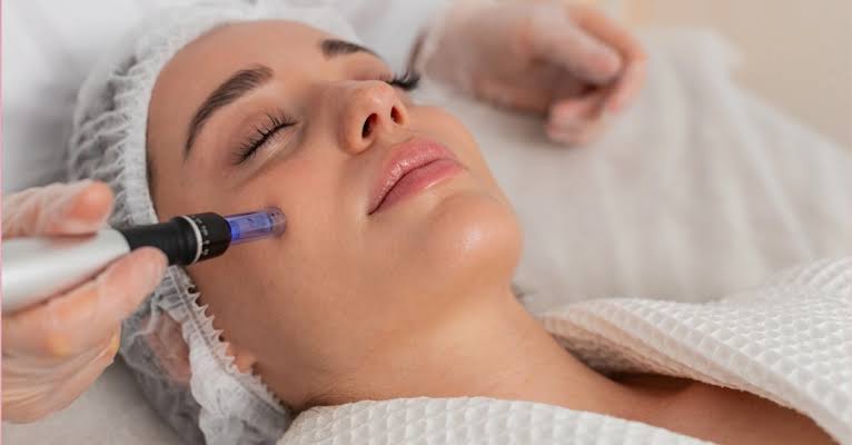 Microneedling img